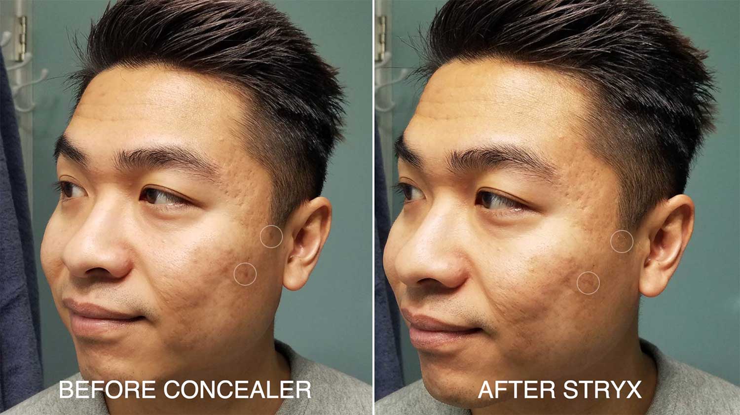 Before And After Stryx Concealer
